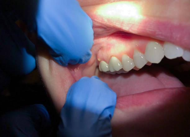 Best Emergency Broken Tooth Repair in Lagrange, IN